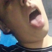 Абајродр Голе