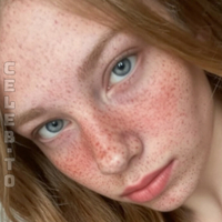 Аласкафреклс Аласкафоун Голе