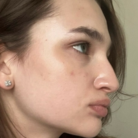 Анохина Лиза Голе