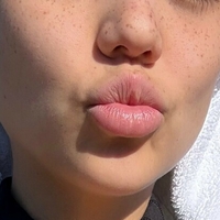 Баоко379 Голе