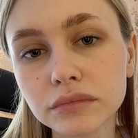 Делеирау Голе