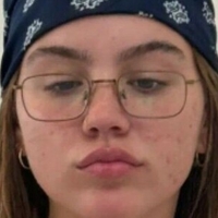 емабруксоксо Голе