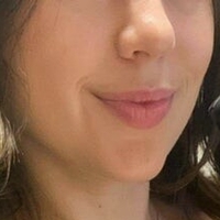 Енфермејра Голе