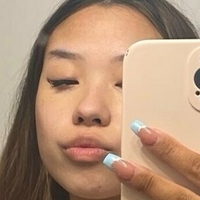 Итселлагрејси Голе