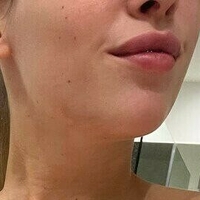 Криста Кореника Голе