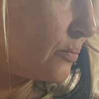 у402025067 Голе