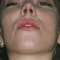 Венусвиксенбејби Голе