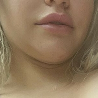 Твој Неко Беби Голе